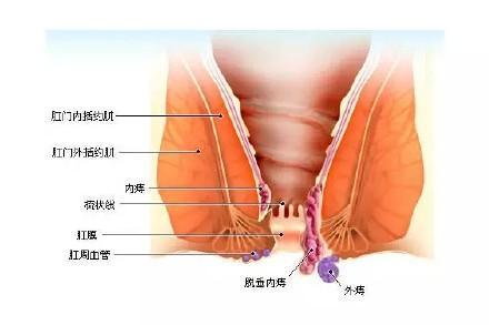 吃小乳瓜对痔疮好吗视频,视频揭秘食疗新选择